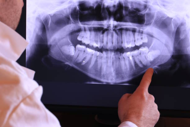 Best Emergency Gum Treatment in Circleville, OH