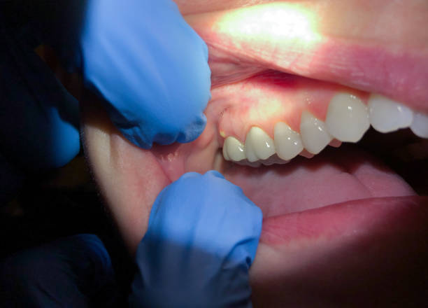 Best Weekend Emergency Dentist in Circleville, OH